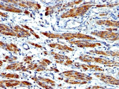 Myosin, Smooth Muscle Heavy Chain Monoclonal Mouse Antibody (MYH11/923 + SMMS-1)
