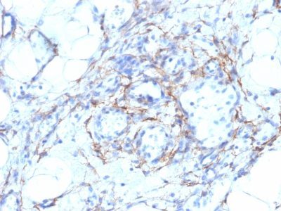 Myosin, Smooth Muscle Heavy Chain Monoclonal Mouse Antibody (MYH11/923 + SMMS-1)
