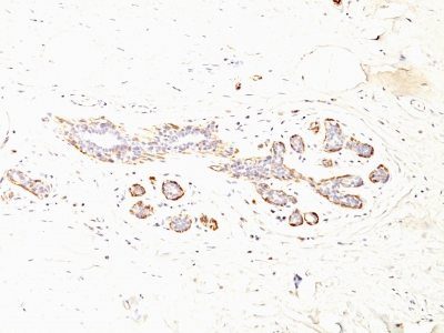 Myosin, Smooth Muscle Heavy Chain Monoclonal Mouse Antibody (MYH11/923 + SMMS-1)