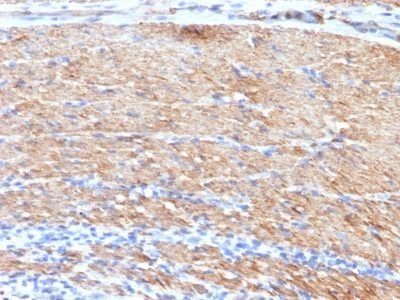 Myosin, Smooth Muscle Heavy Chain Monoclonal Mouse Antibody (MYH11/923 + SMMS-1)