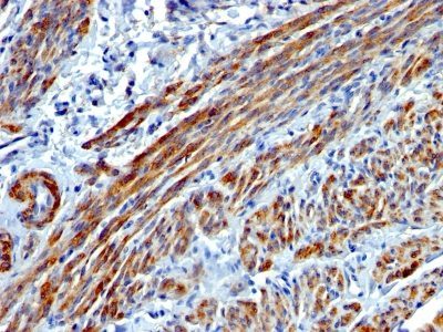 Myosin, Smooth Muscle Heavy Chain Monoclonal Mouse Antibody (MYH11/923)