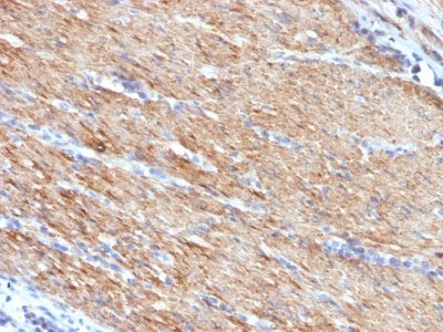 Myosin, Smooth Muscle Heavy Chain Monoclonal Mouse Antibody (MYH11/923)