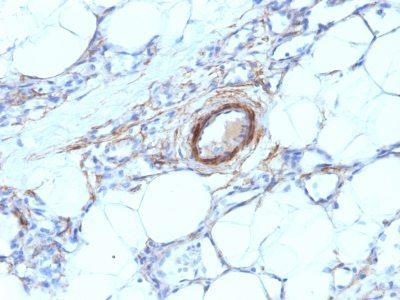 Myosin, Smooth Muscle Heavy Chain Monoclonal Mouse Antibody (MYH11/923)