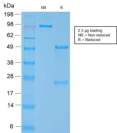 Myosin, Smooth Muscle Heavy Chain Recombinant Monoclonal Rabbit Antibody (MYH11/2303R)