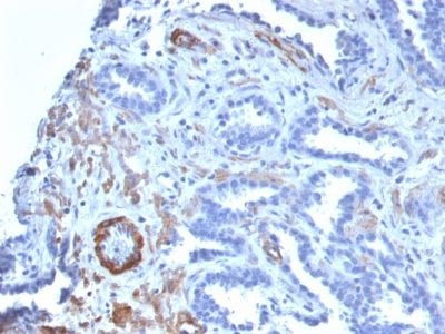 Myosin, Smooth Muscle Heavy Chain Recombinant Monoclonal Rabbit Antibody (MYH11/2303R)