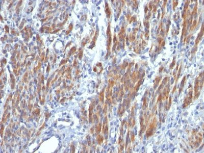 Myosin, Smooth-Muscle Heavy Chain Monoclonal Mouse Antibody (SMMS-1)