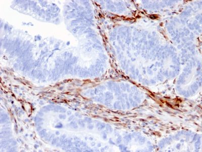 Nestin Monoclonal Mouse Antibody (NES/2911)