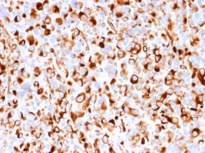 NGF Receptor Recombinant Monoclonal Mouse Antibody (rNGFR/1965)