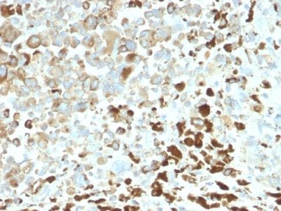 NGF Receptor Recombinant Monoclonal Rabbit Antibody (NGFR/2550R)