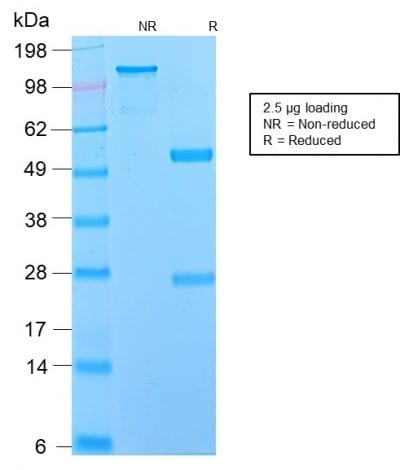 NGF Receptor Recombinant Monoclonal Rabbit Antibody (NGFR/2550R)