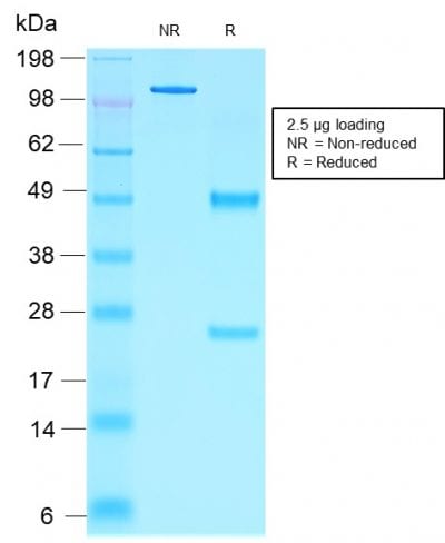 NKX2.2 Recombinant Monoclonal Mouse Antibody (rNX2/1523)