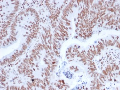 NRF1 Monoclonal Mouse Antibody (NRF1/2608)
