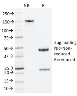 Nucleophosmin Monoclonal Mouse Antibody (NA24)