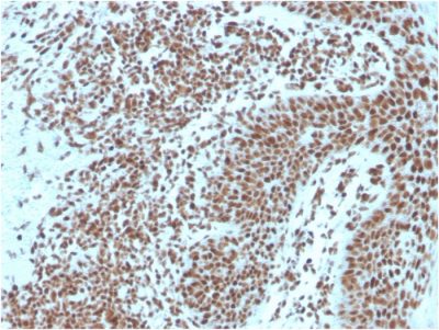 Nucleophosmin Monoclonal Mouse Antibody (NPM1/3287)