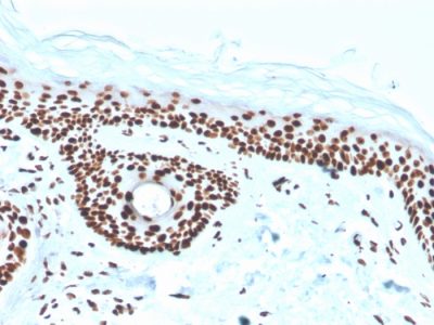 Nucleophosmin Recombinant Monoclonal Mouse Antibody (rNPM1/1901)