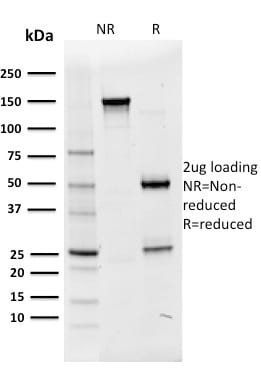Oct2 Monoclonal Mouse Antibody (OCT2/2136)