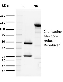 ORC1 Monoclonal Mouse Antibody (7F6/1)