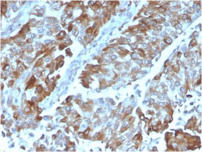 OX40 / CD134/ TNFRSF4 Monoclonal Mouse Antibody (OX40/3108)