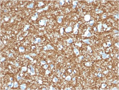 p14ARF Monoclonal Mouse Antibody (4C6/4)
