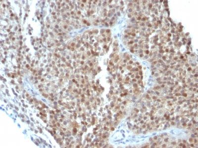 p21 / WAF1 Monoclonal Mouse Antibody (CIP1/823 + DCS-60.2)