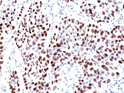 p21 / WAF1 Monoclonal Mouse Antibody (CIP1/823)