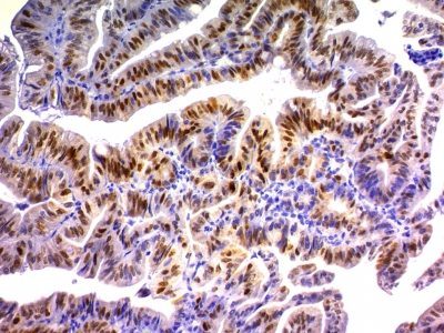 p21 / WAF1 Monoclonal Mouse Antibody (DCS-60.2)