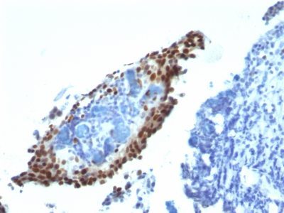 p21 / WAF1 Monoclonal Mouse Antibody (HJ21)