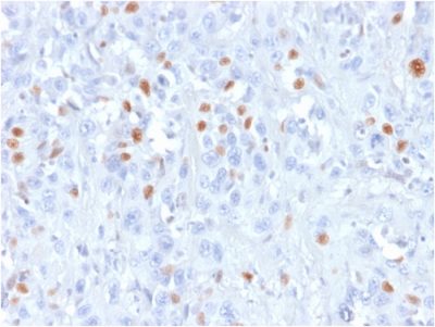 p21 / WAF1 Recombinant Monoclonal Mouse Antibody (rCIP1/823)