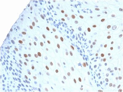 p21 / WAF1 Recombinant Monoclonal Rabbit Antibody (CIP1/2275R)