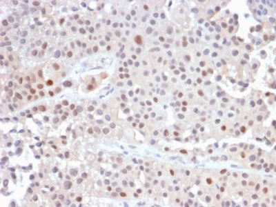 p21 / WAF1 Recombinant Monoclonal Rabbit Antibody (CIP1/2489R)