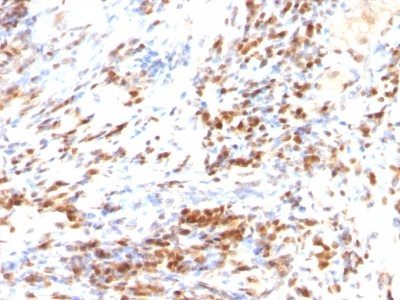 p27 / KIP1 Monoclonal Mouse Antibody (DCS-72.F6 + KIP1/769)