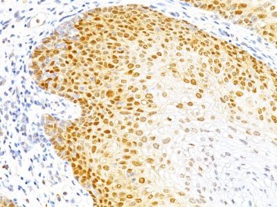 p27 / KIP1 Monoclonal Mouse Antibody (DCS-72.F6)