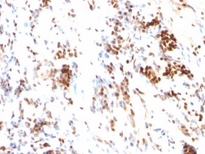 p27 / KIP1 Monoclonal Mouse Antibody (DCS-72.F6)