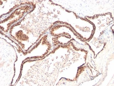 p27 / KIP1 Monoclonal Mouse Antibody (KIP1/769)