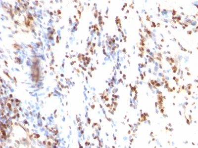 p27 / KIP1 Monoclonal Mouse Antibody (KIP1/769)