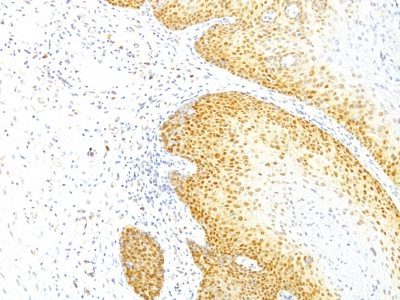 p27 / KIP1 Monoclonal Mouse Antibody (KIP1/769)