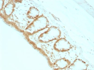 p27 / KIP1 Monoclonal Mouse Antibody (KIP1/769)