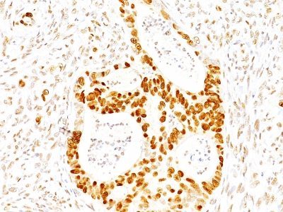 p27 / KIP1 Monoclonal Mouse Antibody (SX53G8)