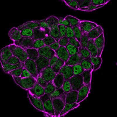p27 / KIP1 Monoclonal Mouse Antibody (SX53G8)