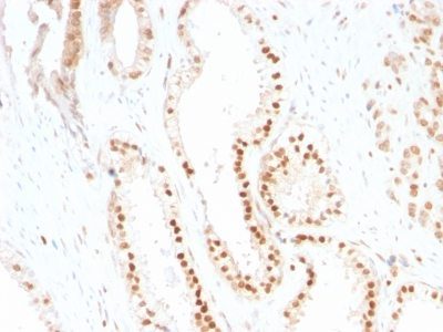 p27 / KIP1 Monoclonal Mouse Antibody (SX53G8)