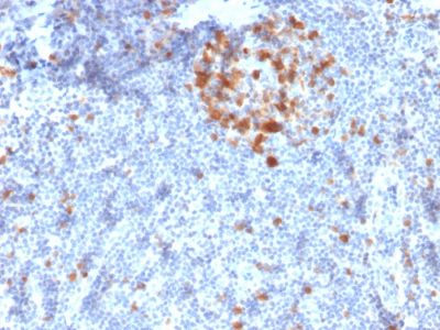 p34 / cdk1 Monoclonal Mouse Antibody (A17.1.1)