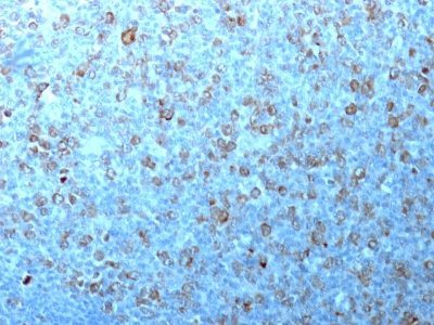 p34 / cdk1 Monoclonal Mouse Antibody (CDK1/873)