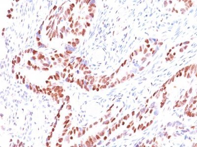 p57 / KIP2 Monoclonal Mouse Antibody (KIP2/880)