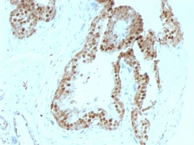 p57 / KIP2 Monoclonal Mouse Antibody (KIP2/880)