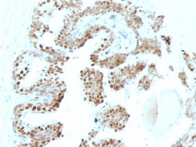 p57 / KIP2 Monoclonal Mouse Antibody (KP10 + KIP2/880)