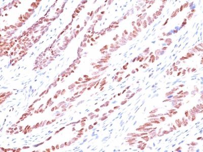 p57 / KIP2 Monoclonal Mouse Antibody (KP10)