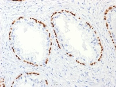 p63 Monoclonal Mouse Antibody (TP63/2427)