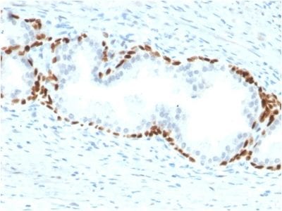 p63 Monoclonal Mouse Antibody (TP63/2428)