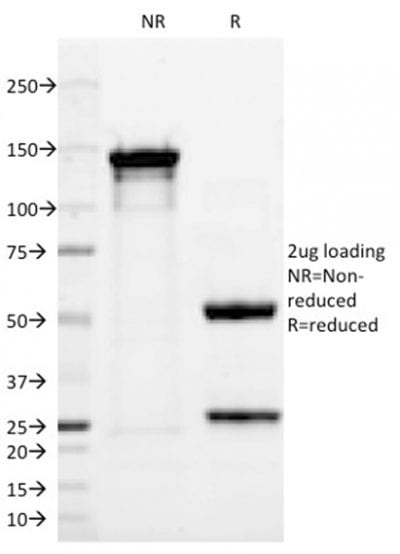 p63 Monoclonal Mouse Antibody (TP63/2428)