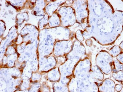 PAPP-A / Pappalysin-1 Monoclonal Mouse Antibody (PAPPA/2715)